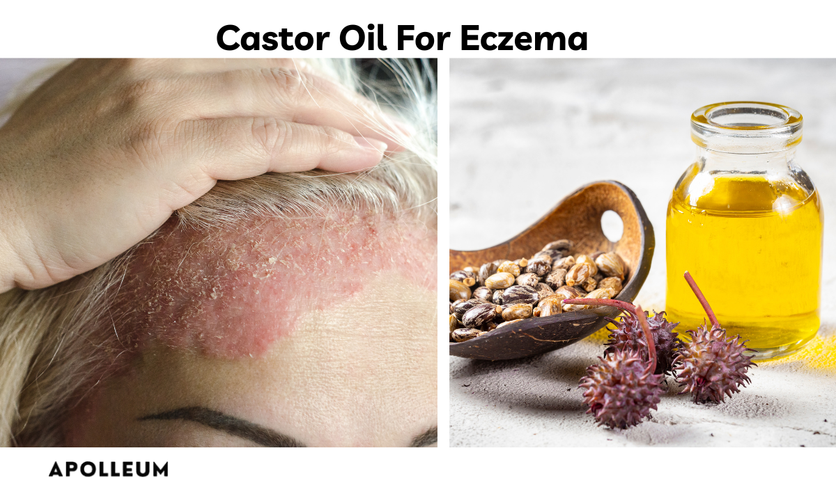 Castor Oil For Eczema