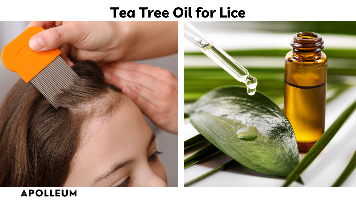 Tea Tree Oil for Lice