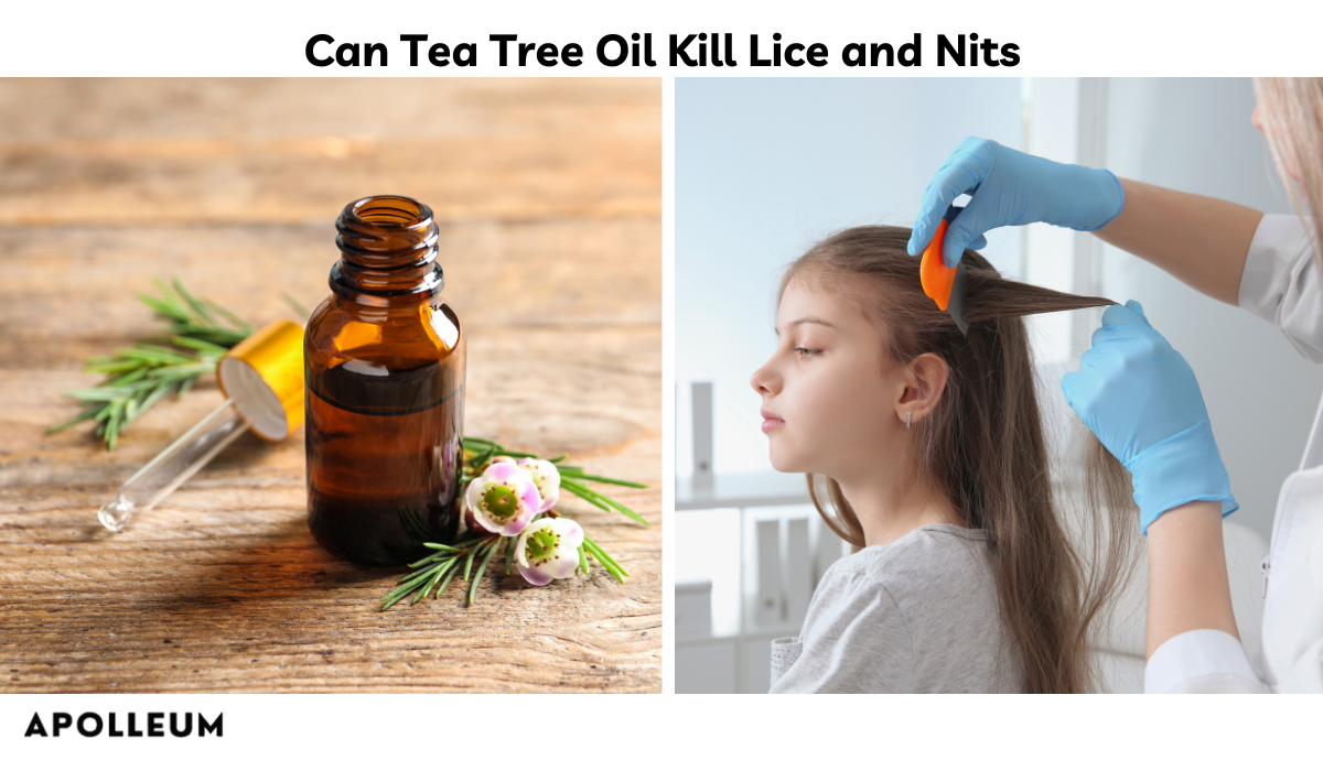 Can Tea Tree Oil Kill Lice and Nits